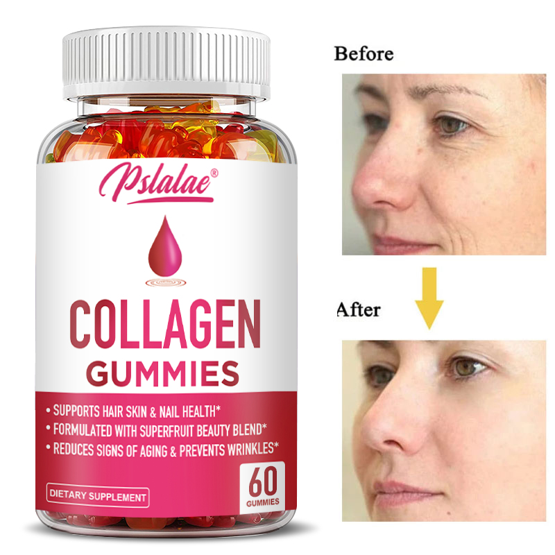 Collagen Gummies - for Overall - Health Wellness Gummies 리뷰 및 가격