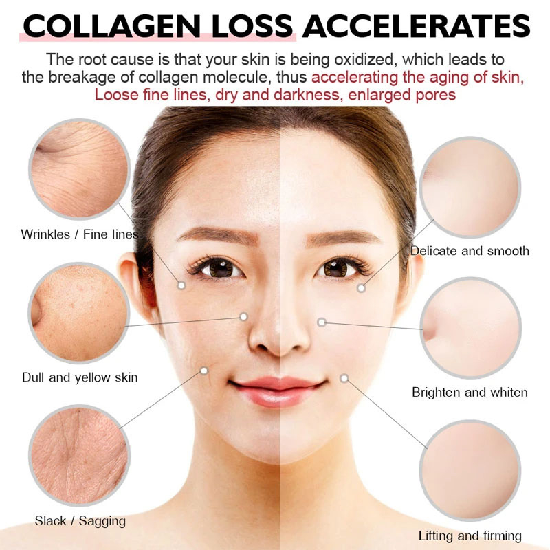 Collagen Gummies - for Overall - Health Wellness Gummies 리뷰 및 가격